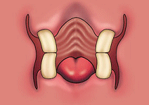 cheekteeth.gif (17708 bytes)