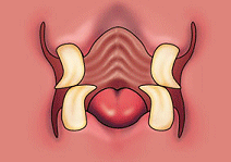 ocheekteeth.gif (17979 bytes)