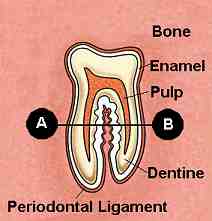 toothacross.jpg (6285 bytes)
